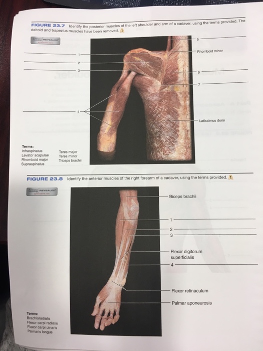 bicipital aponeurosis cadaver