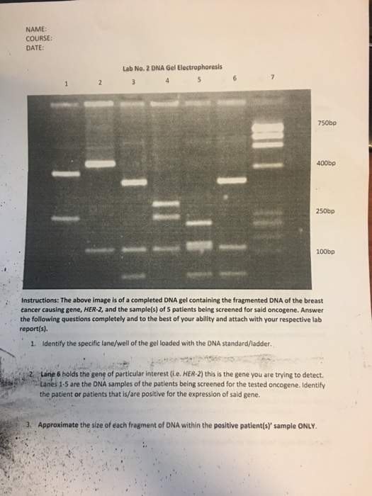 Реферат: Dna Electropherises Essay Research Paper DNA electrophoreses