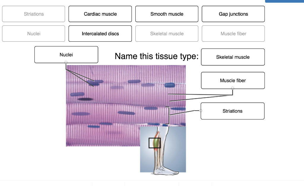 Match the labels on the diagram. Striated muscle Tissue. Fiber и Tissue разница. Cardiac smooth striated muscle. Постановка маркера Tissue.