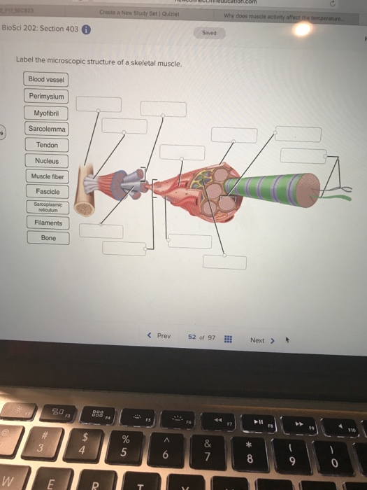 Skeletal Muscle Labeled Microscope