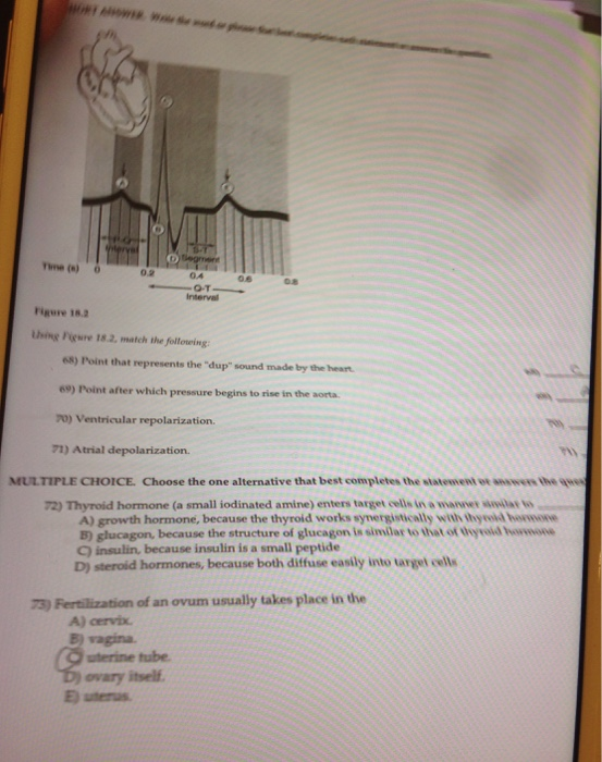 Solved Time () 0.2 04 08 Interval Figure 18.2 Using Pigure | Chegg.com Solved Time () 0.2 04 08 Interval Figure 18.2 Using Pigure | Chegg.com
