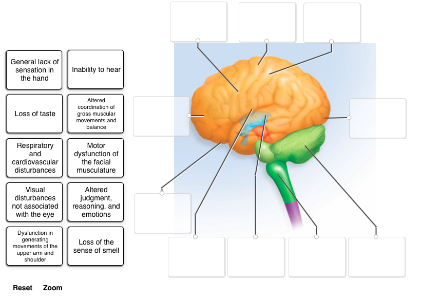 Solved General Lack Of Sensation In Inability To Hear The - 