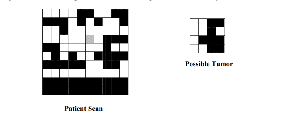 Possible Tumor Patient Scan