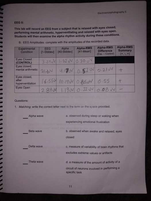 Single subject exhibiting three different closed- eye states in a