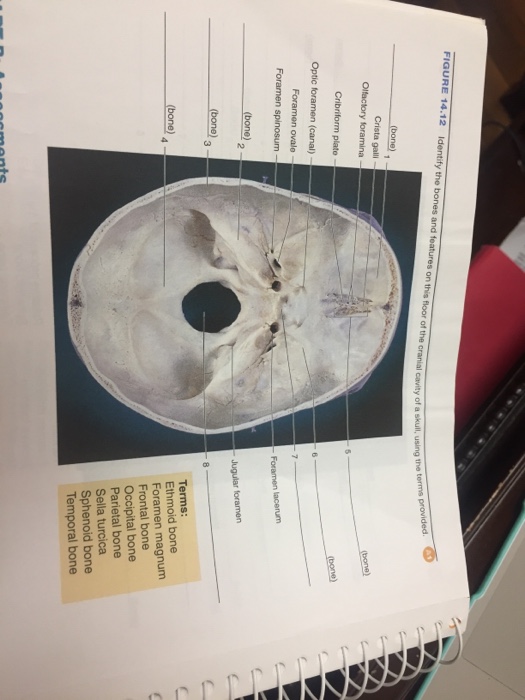 Solved Identify The Bones And Features On This Floor Of T