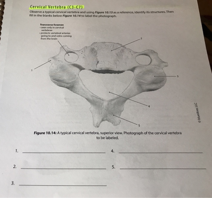 typical cervical vertebra