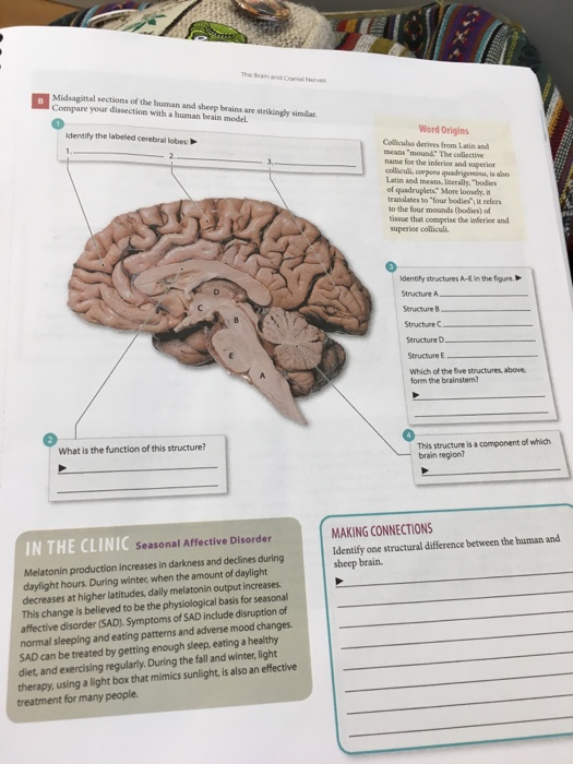 Solved The Brain And Cnanial Nerves Midsagittal Sections