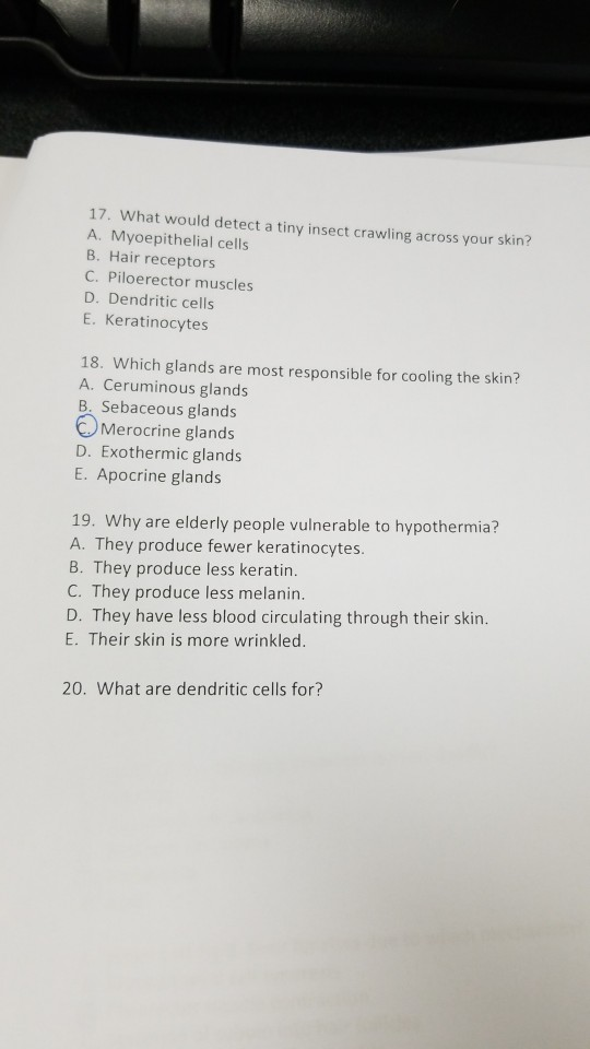Solved 17 What Would Detect A Tiny Insect Crawling Acros