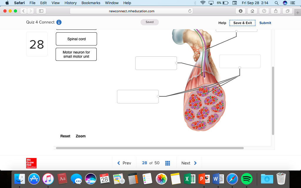 This is a photo of Invaluable Mcgraw Hill Muscle Labeling This is a picture of Invaluable Mcgraw Hill Muscle Labeling