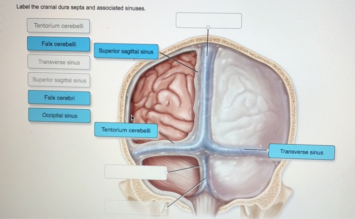 Label The Cranial Dura Septa And Associated Sinuses Chegg Com