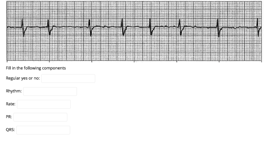 hhhhhh Fill in the following components Regular yes or no: Rhythm: Rate: PR: QRS: