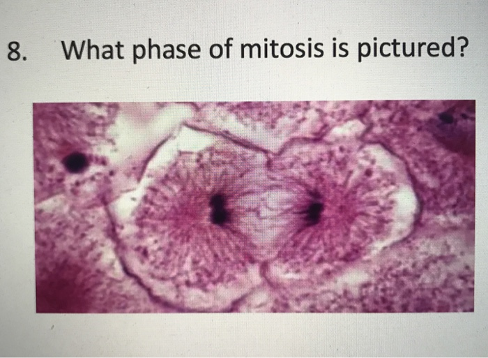 Solved 8. What phase of mitosis is pictured? | Chegg.com