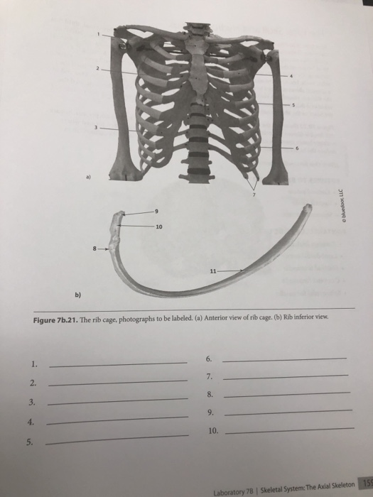 Solved 10 b) Figure 7b.21. The rib cage, photographs to be