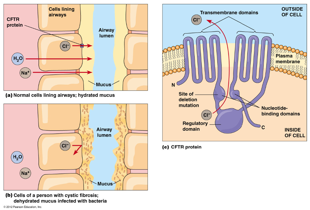 cystic fibrosis and cell membrane case study