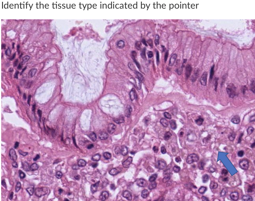 Solved Identify the tissue type indicated by the pointer | Chegg.com