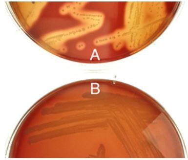 Solved Two different bacterial samples, A and B, were | Chegg.com