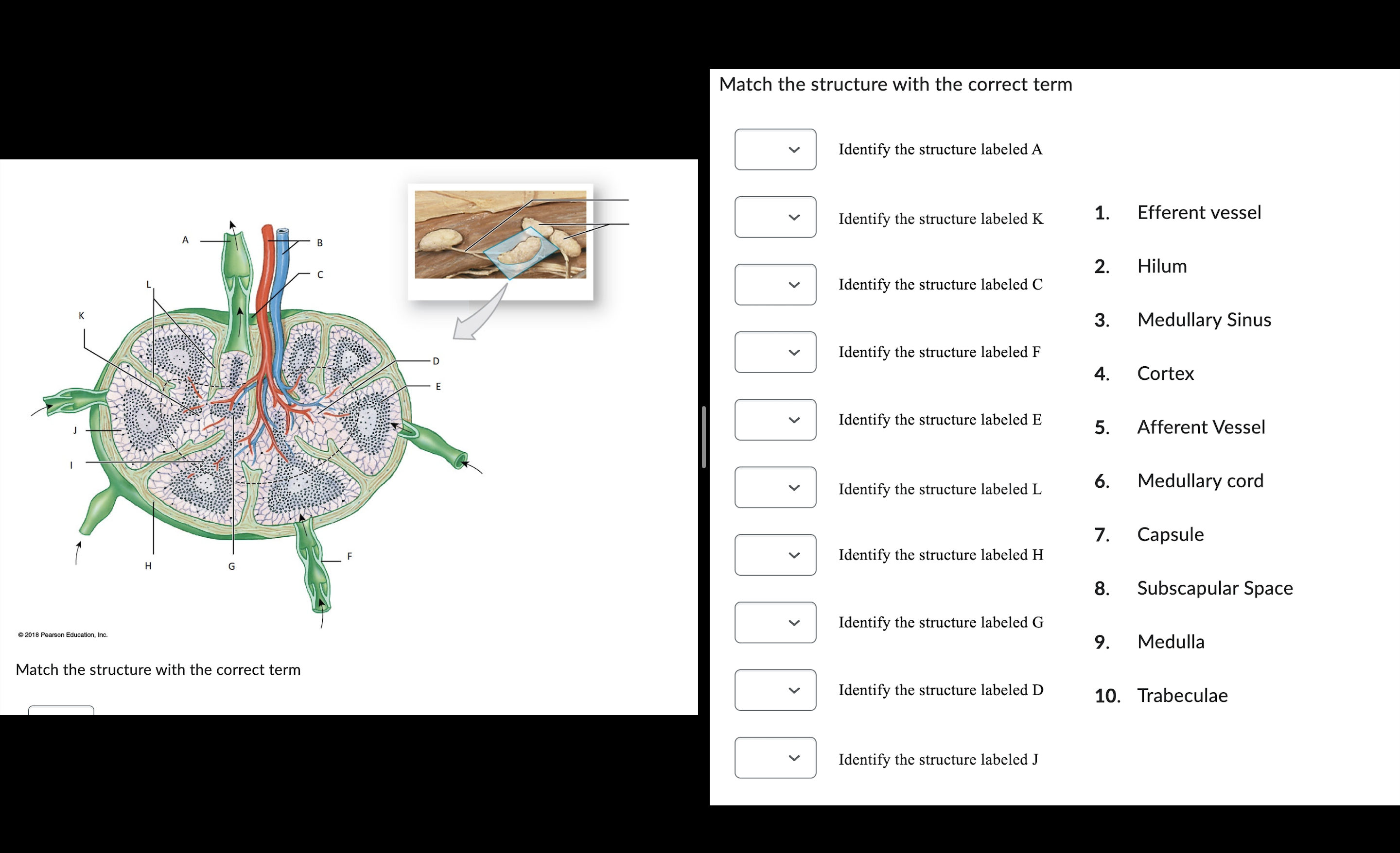 Solved Match The Structure With The Correct Term Match The | Chegg.com