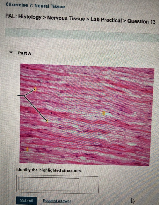 Solved Nervous Tissue > Lab Practical > Question 11 Part A | Chegg.com