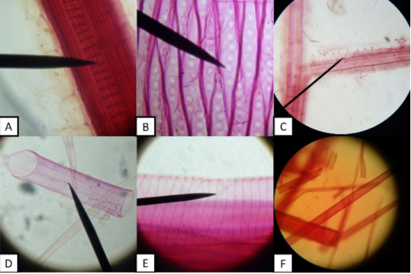 Solved 1. Identify the pattern of secondary cell wall: | Chegg.com