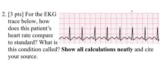 Solved For the EKG below, how does the patients heart rate | Chegg.com