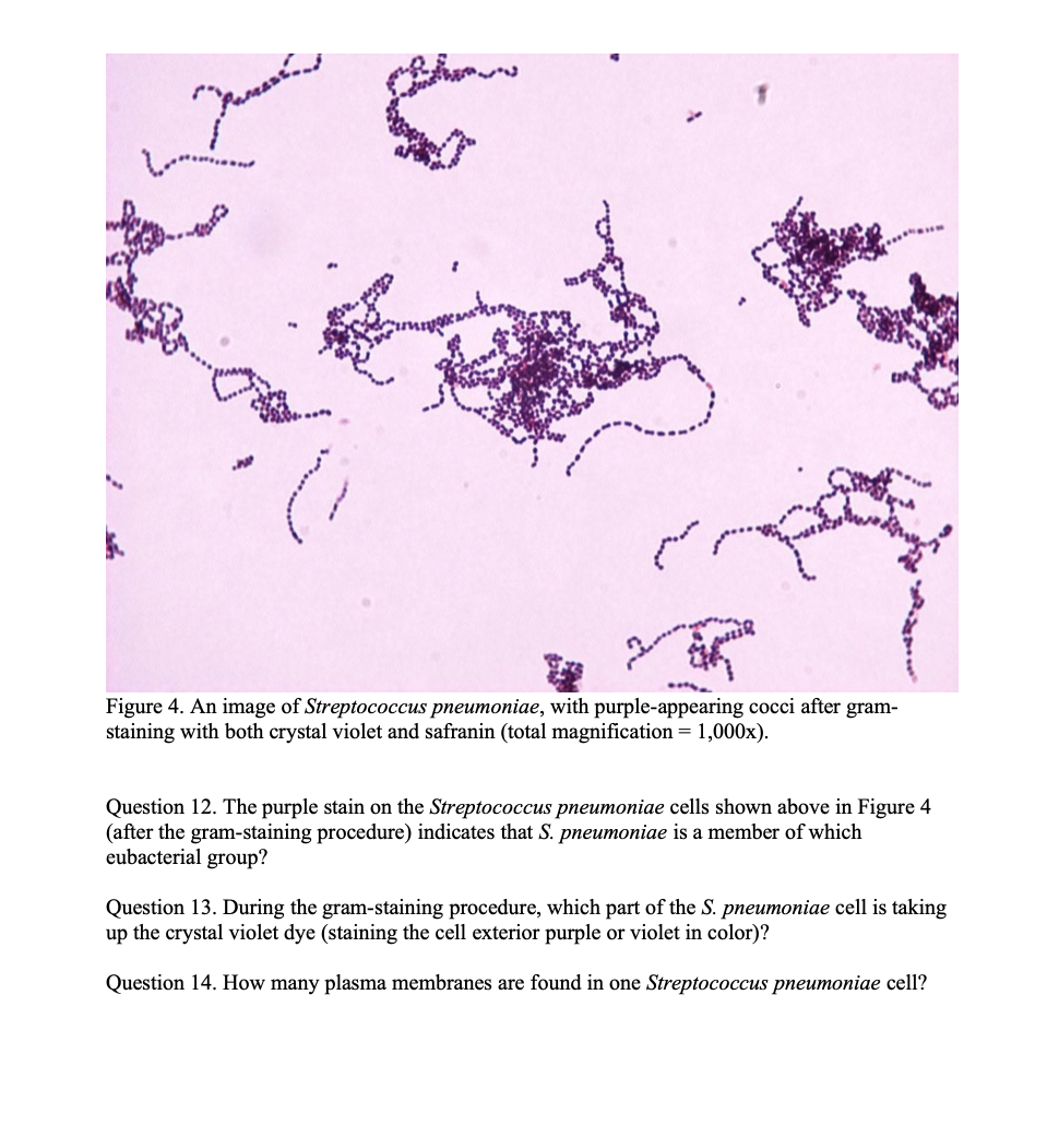 streptococcus pneumoniae under microscope