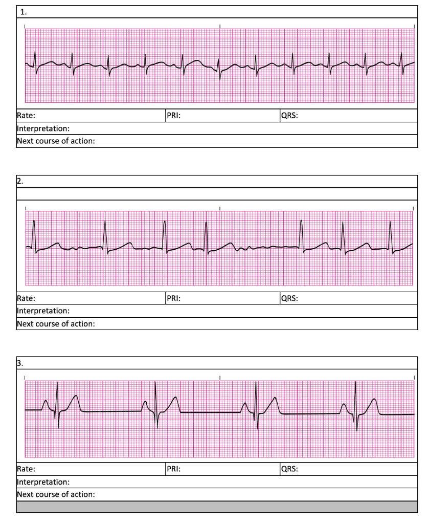 Solved What is the rate, PRI, QRS, and interpretation of | Chegg.com