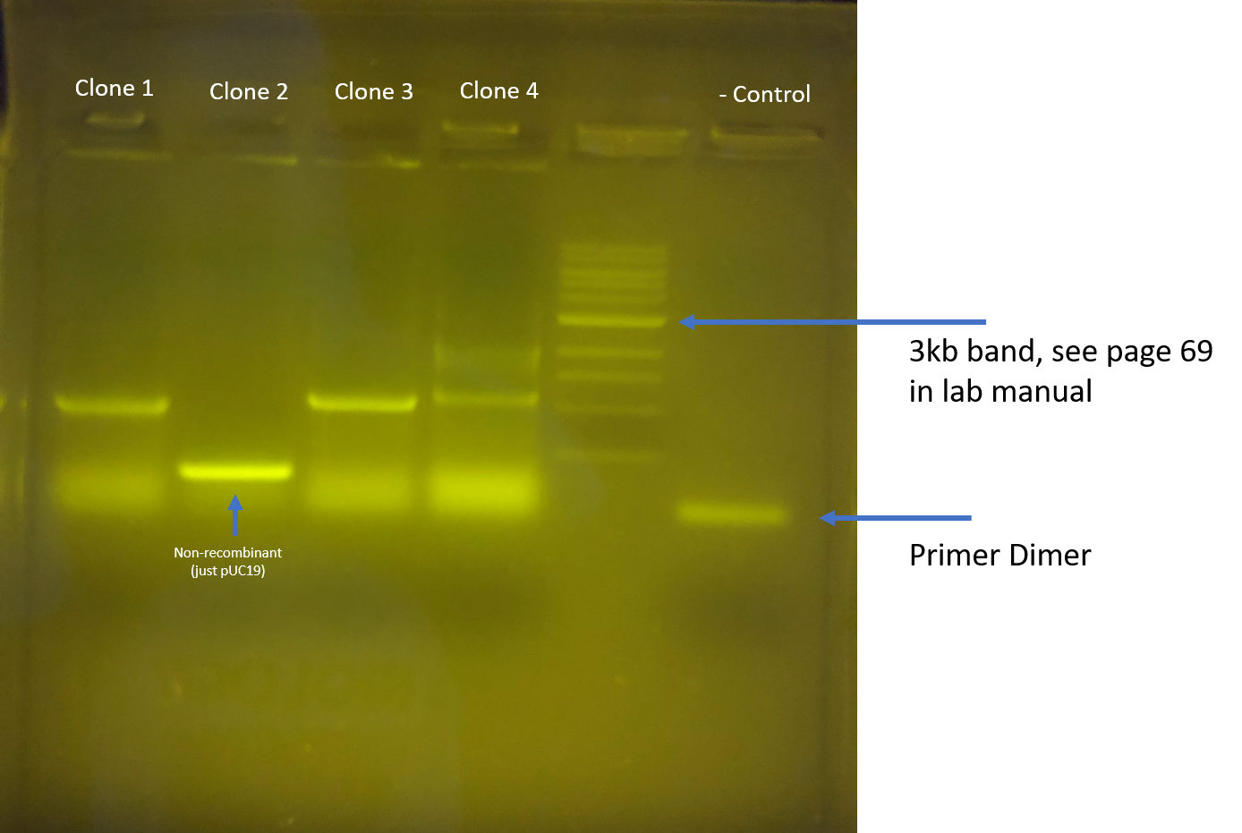 Genomic Yeast Project Agarose Gel Chegg