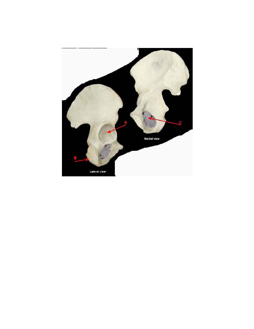 Solved a. Identify the deep depression on the bone indicated 