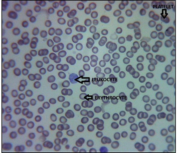 Solved What is the function of platelets. How did these