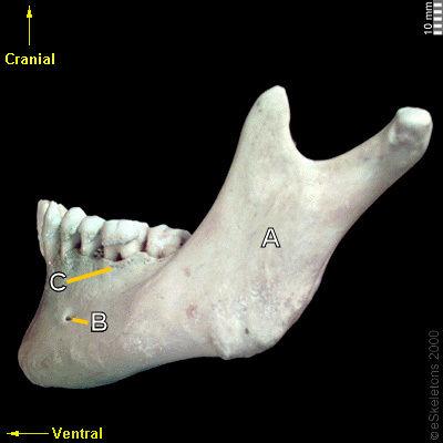 Cranial A B) ⋆ Ventral | Chegg.com