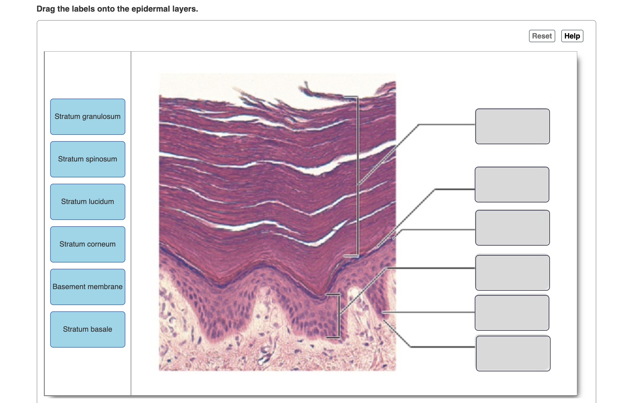 Solved Drag the labels onto the epidermal layers. | Chegg.com