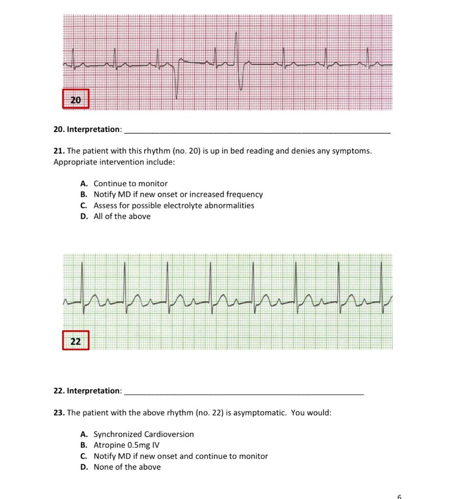 Solved 21. The patient with this rhythm (no. 20) is up in | Chegg.com