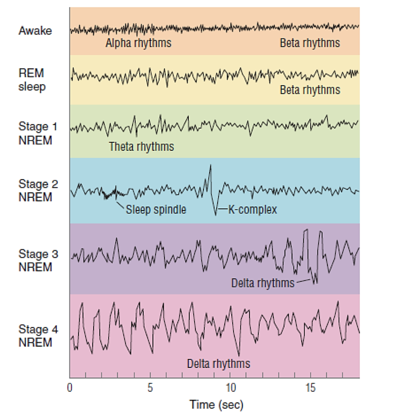 Solved Why are the awake and REM sleep stages both similar