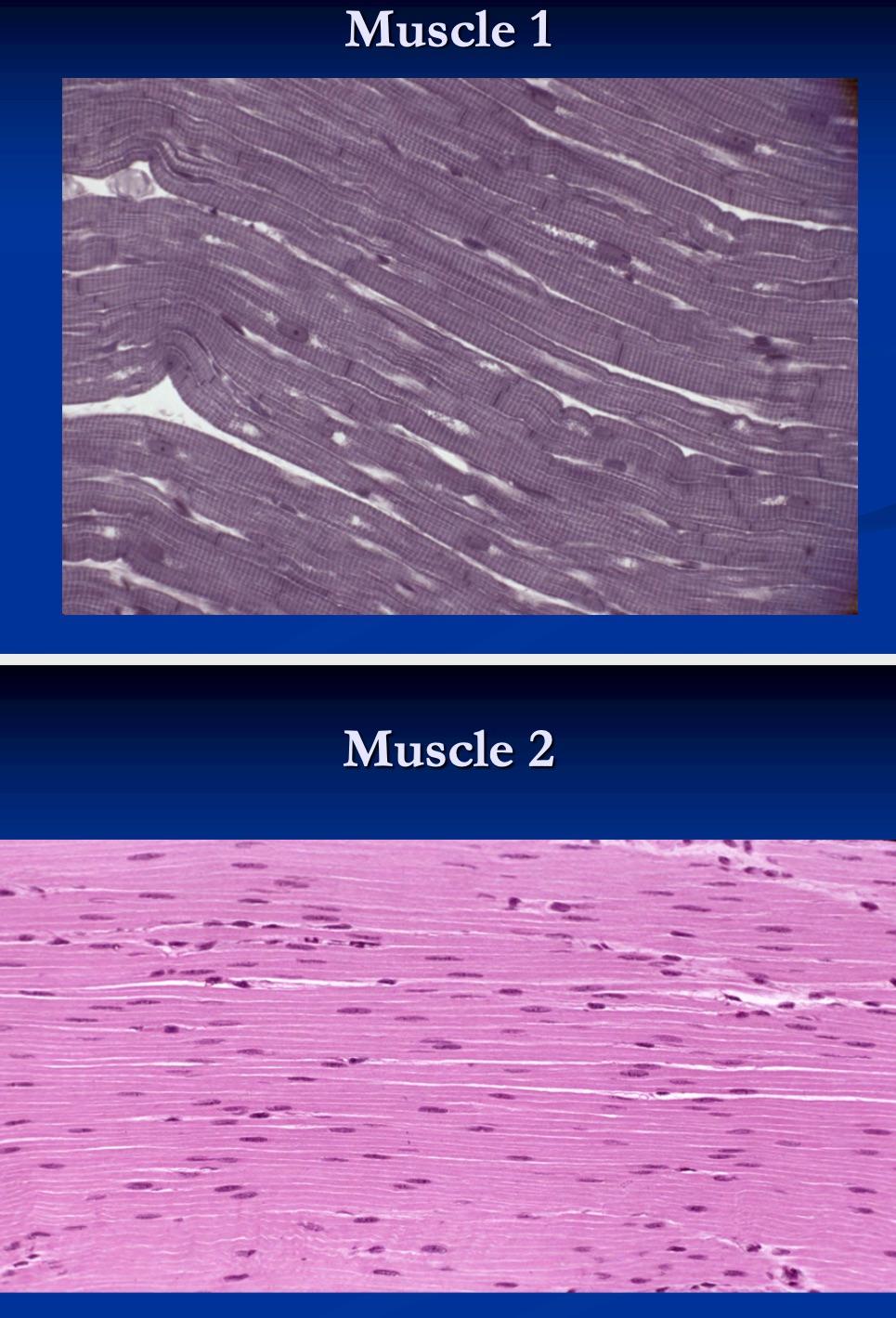 Solved ACTIVITY 4: THE CELLS OF MUSCLE TISSUES Title of the | Chegg.com