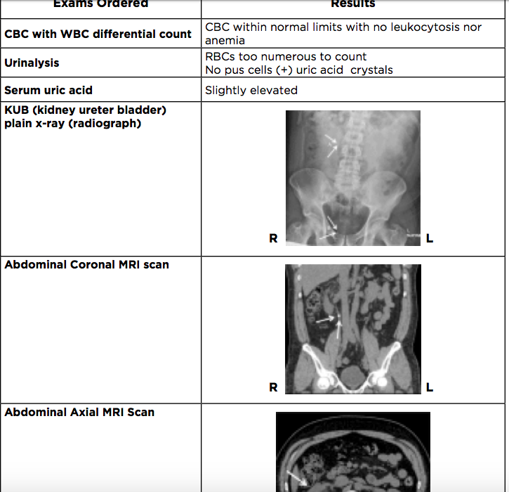 Solved Case Report A 56 Year Old Male Anatomy Professor