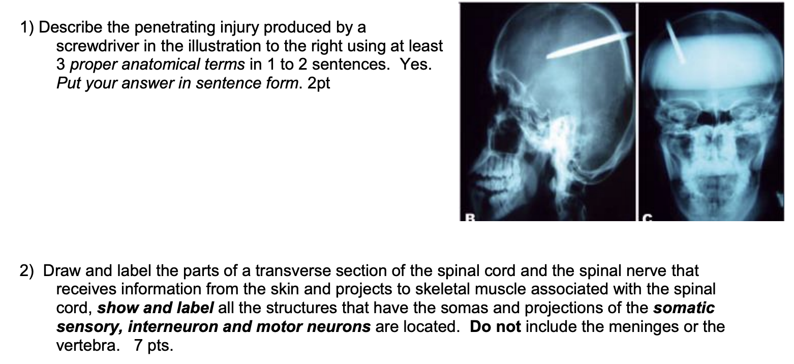 Solved 1) Describe the penetrating injury produced by a | Chegg.com