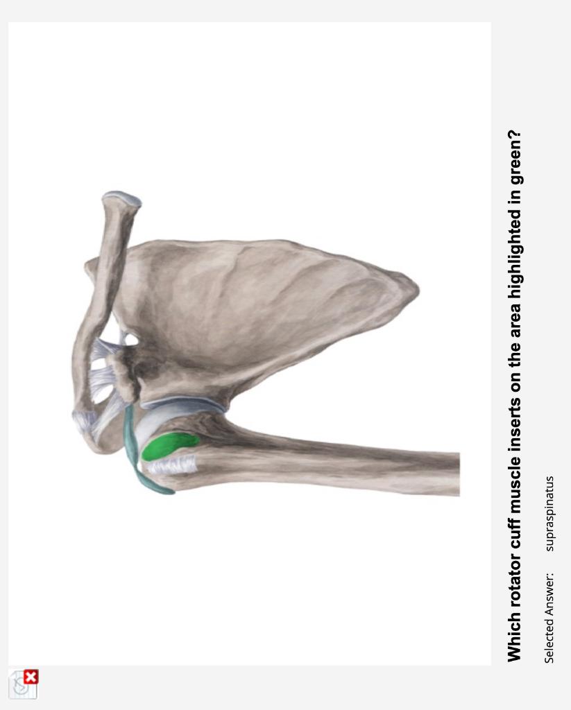 Solved Match the muscle name to the letter. Note: this is a | Chegg.com