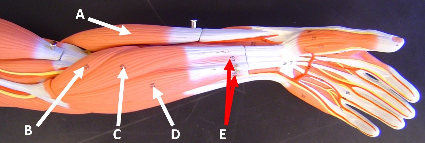 Solved Anatomy And PhysiologyCan You Please Help Me With The | Chegg.com