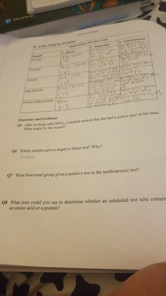 Solved Pears Casein (milk protein) 13 Questions and Problems