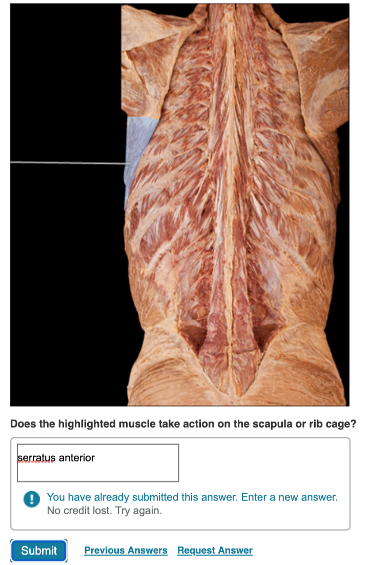 Solved Does The Highlighted Muscle Take Action On The Sca Chegg Com