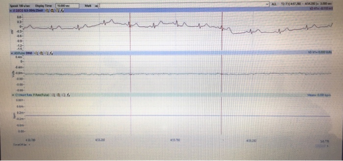 How does the average T-P interval from rest and each | Chegg.com