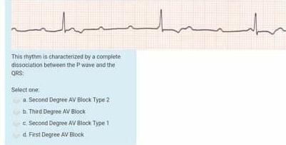 Solved الہ This thythm is characterized by a complete | Chegg.com