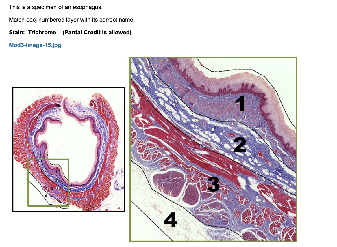 This is a specimen of an esophagus.
Match eacj numbered layer with its correct name.
Stain: Trichrome (Partial Credit is allo