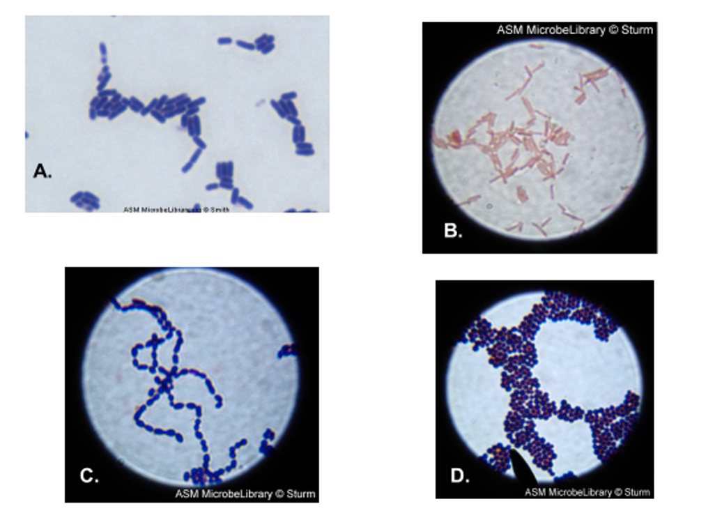 Solved ASM MicrobeLibrary Sturm A. ASM Minhen B. c. D. ASM | Chegg.com