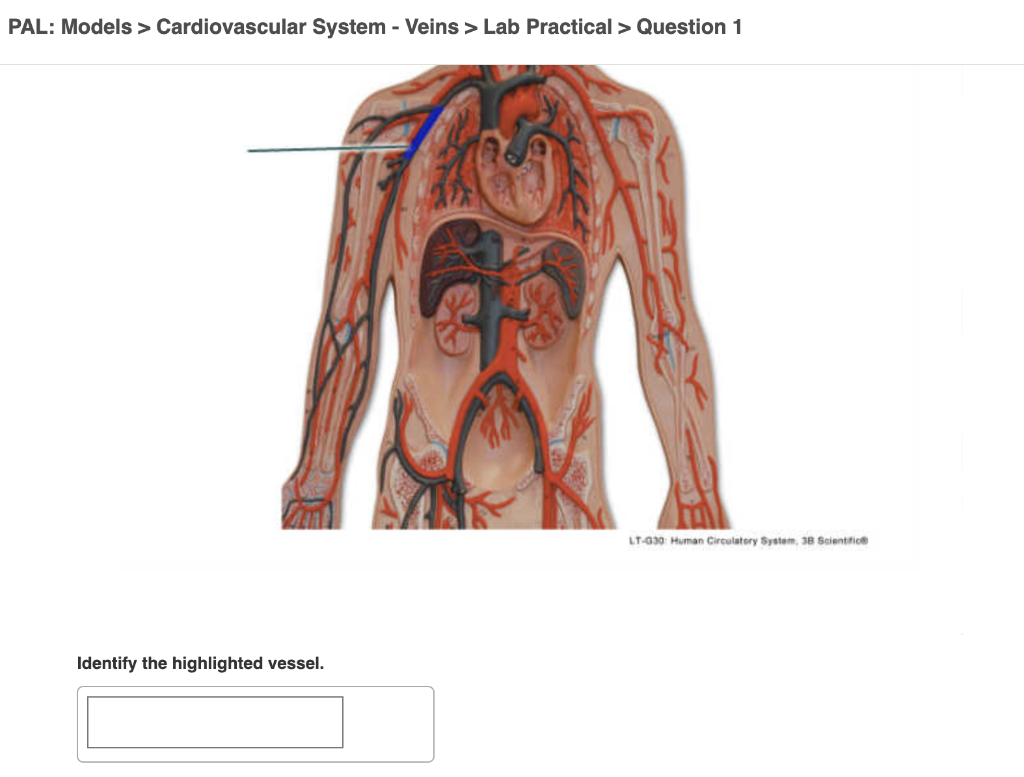 Solved PAL Models > Cardiovascular System Arteries > Lab