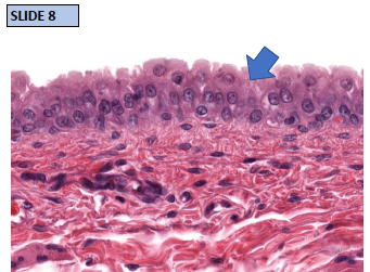 Solved Name the tissue that is located at the tip of the | Chegg.com