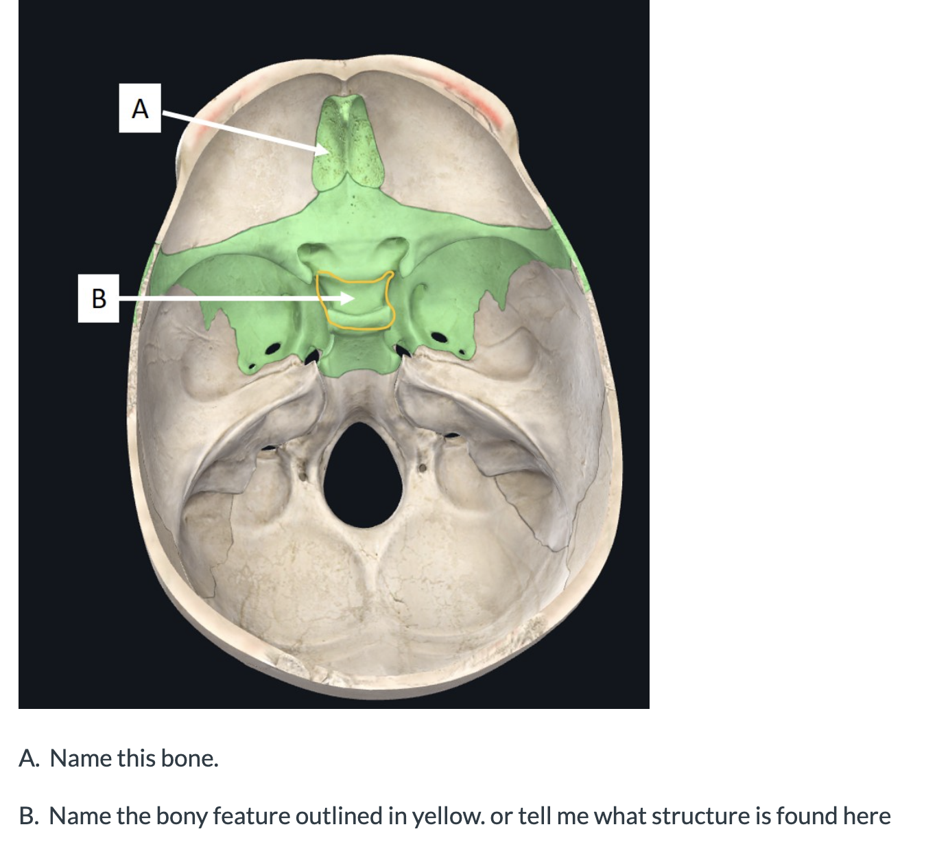 Solved A. Name this bone. B. Name the bony feature outlined | Chegg.com