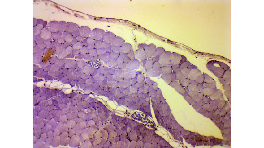 Solved Label A Fascicle Perimysium Epimysium Chegg Com