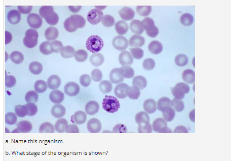 Solved A. Name This Organism. B. What Stage Of The Organism | Chegg.com