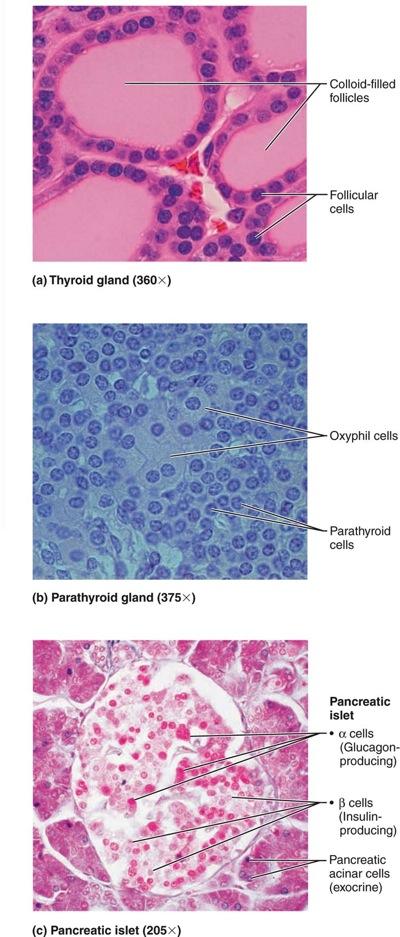 Solved (a) Thyroid gland (360×) (b) Parathyroid gland (375×) | Chegg.com